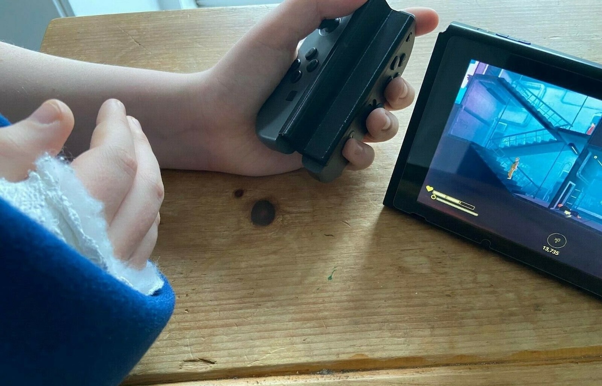 Detalle de unas manos, una de ellas escayolada, jugando a Nintendo Switch y cogiendo los mandos de manera distinta